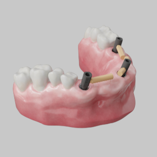 Implantology